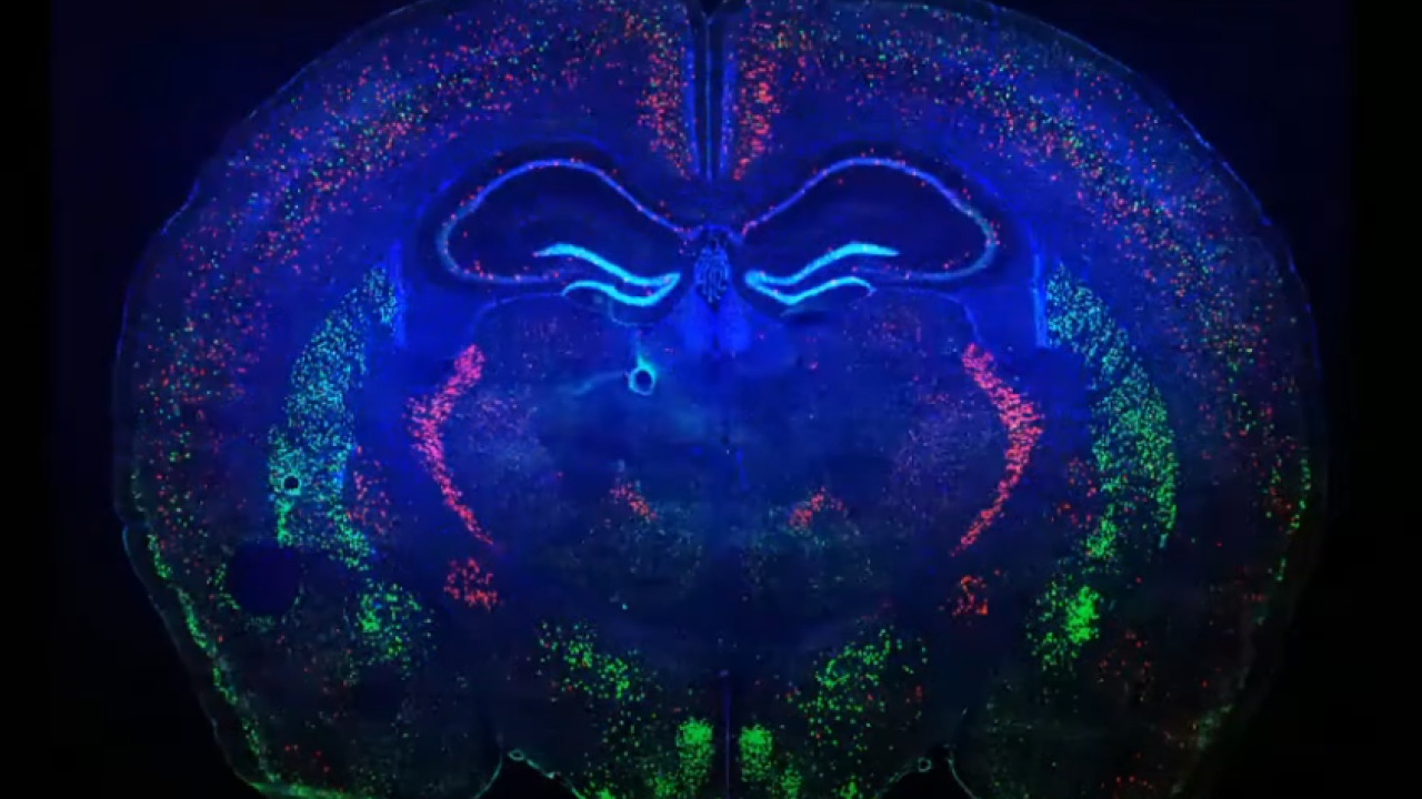 Allen Brain Atlas