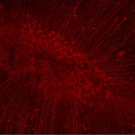 Picture of eye